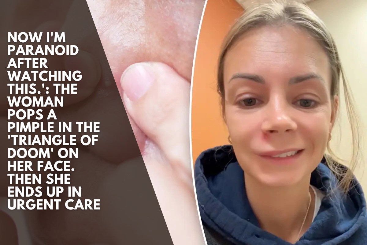 Now I'm paranoid after watching this.': The woman pops a pimple in the 'triangle of doom' on her face. Then she ends up in Urgent Care