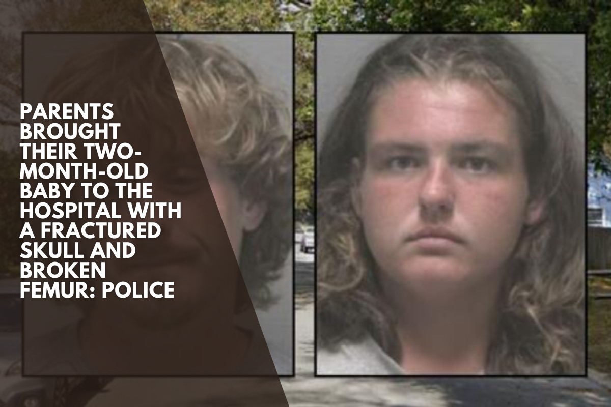 Parents brought their two-month-old baby to the hospital with a fractured skull and broken femur: Police
